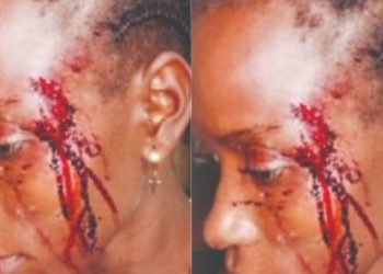 Fourah Bay College lecturer beats neighbour