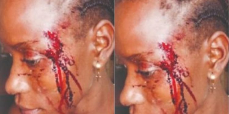 Fourah Bay College lecturer beats neighbour