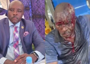 Opposition MP Survives Assassination Attempt, Sustained Serious Injuries