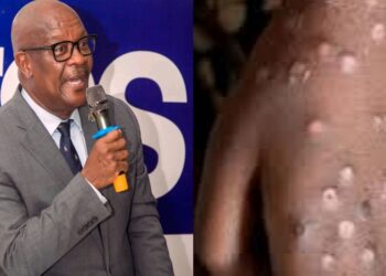 Health Minister Reveals Reason for Surge in Mpox Cases in Sierra Leone 