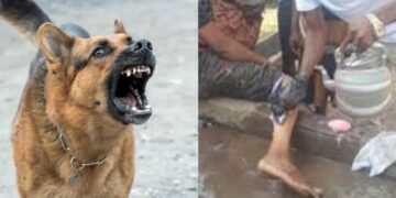 Dog Bites In Bombali Jump From 383 To 469 As Govt Vows To End Rabies Deaths By 2030